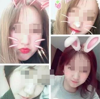 我想变美可未满18岁,可以割双眼皮么?