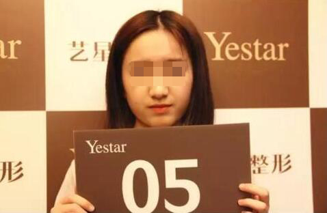 我想变美可未满18岁,可以割双眼皮么?