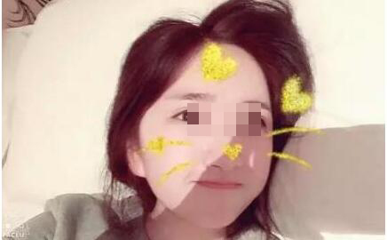 我想变美可未满18岁,可以割双眼皮么?